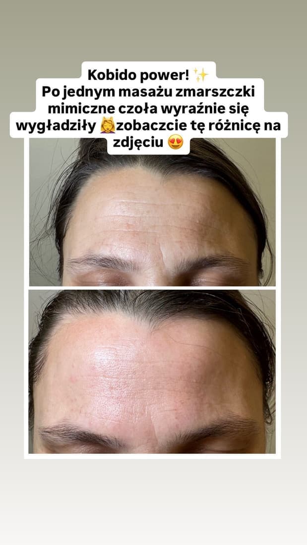 Efekt zabiegu