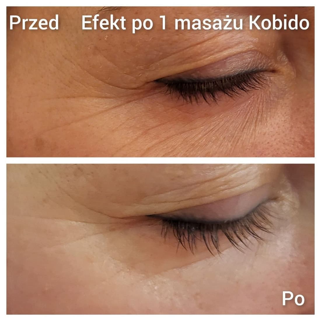 Efekt po masażu Kobido